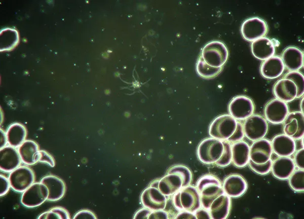 feerkracht vervolgafspraken