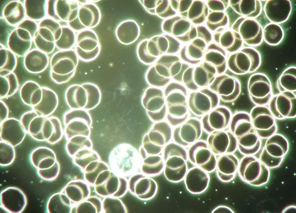 levend bloed analyse intake